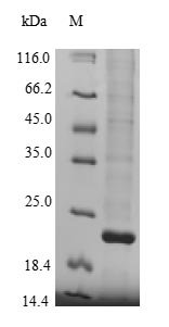 Human Lysine-specific demethylase 5A (KDM5A), partial Recombinant Protein, Homo sapiens (Human), Yeast, N-terminal 6xHis-tagged, 21.3 kDa, purity >≥ 90% as determined by SDS-PAGE.