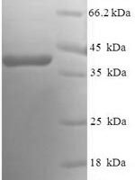 Human Ras-related protein Rab-5A (RAB5A) Recombinant Protein - BioCrest Sci