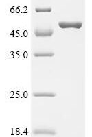 Shigella flexneri Outer membrane protein assembly factor BamA (bamA), partial Recombinant Protein - BioCrest Sci