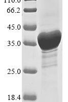 Human Receptor tyrosine-protein kinase erbB-2 (ERBB2), partial Recombinant Protein - BioCrest Sci