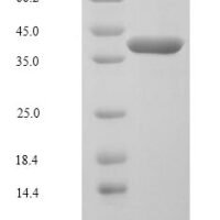 Human Dual specificity mitogen-activated protein kinase kinase 6 (MAP2K6) Recombinant Protein, N-His - BioCrest Sci