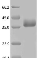Human Leucine-rich repeat and transmembrane domain-containing protein 2 (LRTM2), partial Recombinant Protein - BioCrest Sci