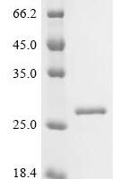Pseudomonas putida Arginine/ornithine antiporter (arcD), partial Recombinant Protein - BioCrest Sci