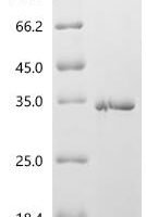 Mouse Collagen alpha-1 (XVI) chain (Col16a1), partial Recombinant Protein - BioCrest Sci