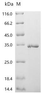 Mouse Collagen alpha-1 (XVI) chain (Col16a1), partial Recombinant Protein, Mus musculus (Mouse), E.coli, C-terminal 6xHis-tagged, 30.3 kDa, purity >≥ 95% as determined by SDS-PAGE.