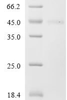 Mouse Fibronectin (Fn1), partial Recombinant Protein, C-10His - BioCrest Sci