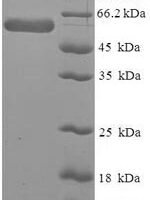Human Leukocyte elastase inhibitor (SERPINB1) Recombinant Protein - BioCrest Sci