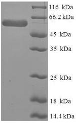 Human Leukocyte elastase inhibitor (SERPINB1) Recombinant Protein, Homo sapiens (Human), E.coli, N-terminal 6xHis-SUMO-tagged, 58.7 kDa, purity >≥ 90% as determined by SDS-PAGE.