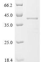 Eisenia fetida Lysenin Recombinant Protein, N-10His - BioCrest Sci