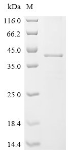 Eisenia fetida Lysenin Recombinant Protein, N-10His, Eisenia fetida (Red wiggler worm), in vitro E.coli expression system, N-terminal 10xHis-tagged, 34.9 kDa, purity >≥ 85% as determined by SDS-PAGE.