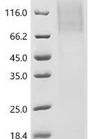 Human Eosinophil peroxidase (EPX) Recombinant Protein, C-His, aa 140–715, Yeast - BioCrest Sci