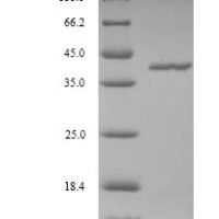 Vaccinia virus Protein L3 (VACWR090) Recombinant Protein - BioCrest Sci