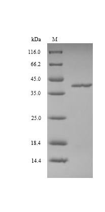 Vaccinia virus Protein L3 (VACWR090) Recombinant Protein, Vaccinia virus (strain Western Reserve) (VACV) (Vaccinia virus (strain WR)), Yeast, N-terminal 6xHis-tagged, 42.6 kDa, purity >≥ 90% as determined by SDS-PAGE.