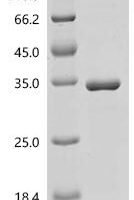 Human Caspase-9 (CASP9), partial Recombinant Protein - BioCrest Sci
