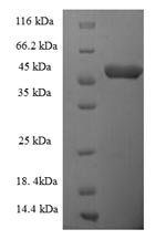 Caenorhabditis elegans ATP-dependent (S)-NAD (P)H-hydrate dehydratase (R107.2) Recombinant Protein, Caenorhabditis elegans, E.coli, N-terminal 6xHis-SUMO-tagged, 49.9 kDa, purity >≥ 90% as determined by SDS-PAGE.