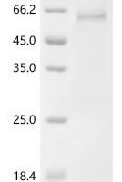 Human Sushi repeat-containing protein SRPX2（SRPX2) Recombinant Protein - BioCrest Sci