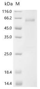 Human Sushi repeat-containing protein SRPX2(SRPX2) Recombinant Protein, Homo sapiens (Human), Mammalian cell, C-terminal 10xHis-tagged, 52.3 kDa, purity >≥ 90% as determined by SDS-PAGE.