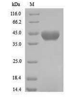 Bradyrhizobium sp. Formamidase (amiF) Recombinant Protein - BioCrest Sci