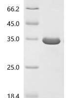 Streptococcus sp. group G Immunoglobulin G-binding protein G (spg), partial Recombinant Protein, C-His, aa 291–497, Purity ≥85% - BioCrest Sci