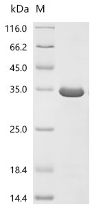 Streptococcus sp. group G Immunoglobulin G-binding protein G (spg), partial Recombinant Protein, C-His, aa 291–497, Purity ≥85%, Streptococcus sp. group G, E.coli, C-terminal 6xHis-tagged, 29.9 kDa, purity >≥ 85% as determined by SDS-PAGE.