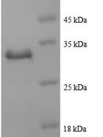 Human Actin, cytoplasmic 1 (ACTB), partial Recombinant Protein - BioCrest Sci