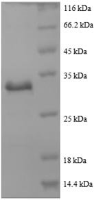 Human Actin, cytoplasmic 1 (ACTB), partial Recombinant Protein, Homo sapiens (Human), E.coli, N-terminal 6xHis-tagged, 34.6 kDa, purity >≥ 90% as determined by SDS-PAGE.