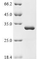 Human N-terminal Xaa-Pro-Lys N-methyltransferase 2 (NTMT2) Recombinant Protein - BioCrest Sci