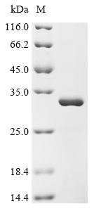 Human N-terminal Xaa-Pro-Lys N-methyltransferase 2 (NTMT2) Recombinant Protein, Homo sapiens (Human), E.coli, C-terminal 6xHis-tagged, 33.5 kDa, purity >≥ 95% as determined by SDS-PAGE.