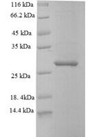 Mouse Deoxynucleoside triphosphate triphosphohydrolase SAMHD1 (Samhd1), partial Recombinant Protein - BioCrest Sci