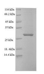 Mouse Deoxynucleoside triphosphate triphosphohydrolase SAMHD1 (Samhd1), partial Recombinant Protein, Mus musculus (Mouse), E.coli, N-terminal 6xHis-tagged, 30.6 kDa, purity >≥ 90% as determined by SDS-PAGE.