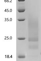 Human Synaptic vesicle glycoprotein 2C (SV2C), partial Recombinant Protein, C-His, aa 459–578, Yeast - BioCrest Sci