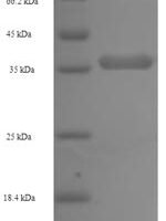 Pan troglodytes Lymphotoxin-beta (LTB), partial Recombinant Protein - BioCrest Sci