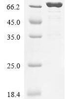 Streptococcus pneumoniae serotype 4 Autolysin (lytA), Biotinylated Recombinant Protein - BioCrest Sci