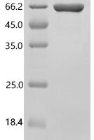 Human Collagen alpha-1 (VIII) chain (COL8A1), partial, Biotinylated Recombinant Protein - BioCrest Sci