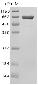 Human Collagen alpha-1 (VIII) chain (COL8A1), partial, Biotinylated Recombinant Protein, Homo sapiens (Human), E.coli, N-terminal MBP-tagged and C-terminal 6xHis-Avi-tagged, 66.7 kDa, purity >≥ 90% as determined by SDS-PAGE.