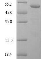 Human Deoxyribonuclease gamma (DNASE1L3) Recombinant Protein, N-GST - BioCrest Sci