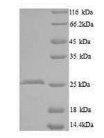 Mouse CCN family member 5 (Ccn5) Recombinant Protein - BioCrest Sci