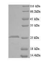 Mouse CCN family member 5 (Ccn5) Recombinant Protein, Mus musculus (Mouse), Yeast, N-terminal 6xHis-tagged, 26.5 kDa, purity >≥ 90% as determined by SDS-PAGE.