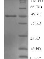Human Tyrosine-protein phosphatase non-receptor type 5 (PTPN5), partial Recombinant Protein - BioCrest Sci