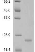 Mouse Bone morphogenetic protein 4 (Bmp4) Recombinant Protein, N-His - BioCrest Sci