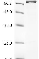 Human Serine/threonine-protein kinase RIO3 (RIOK3) Recombinant Protein - BioCrest Sci