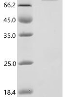 Mouse Microtubule-actin cross-linking factor 1, isoforms 1/2/3/4 (Macf1), partial Recombinant Protein - BioCrest Sci