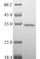 Porcine parvovirus Capsid protein VP1, partial Recombinant Protein - BioCrest Sci