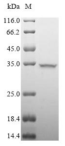 Porcine parvovirus Capsid protein VP1, partial Recombinant Protein, Porcine parvovirus (strain NADL-2) (PPV), Mammalian cell, N-terminal 10xHis-tagged and C-terminal Myc-tagged, 26.4 kDa, purity >≥ 85% as determined by SDS-PAGE.