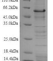 Eisenia fetida Lysenin Recombinant Protein, N-10His-SUMO/C-Myc - BioCrest Sci