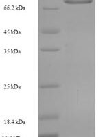 Human Arylsulfatase G (ARSG) Recombinant Protein - BioCrest Sci