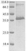 Human Cannabinoid receptor 2 (CNR2) Recombinant Protein - BioCrest Sci