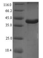 Rat Complement C1q subcomponent subunit A (C1qa) Recombinant Protein - BioCrest Sci