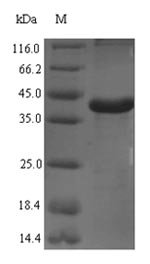 Rat Complement C1q subcomponent subunit A (C1qa) Recombinant Protein, Rattus norvegicus (Rat), E.coli, N-terminal 6xHis-SUMO-tagged, 39.6 kDa, purity >≥ 90% as determined by SDS-PAGE.
