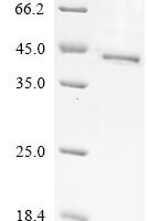 Human Protein Wnt-4 (WNT4) Recombinant Protein, C-His - BioCrest Sci